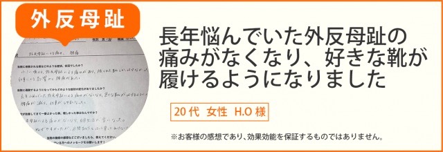 患者様の声　外反母趾　20代女性　H.O様