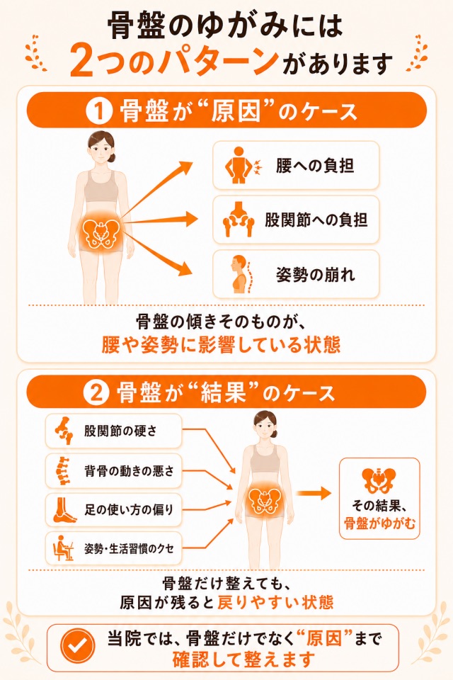 "骨盤のゆがみの原因と結果の違いを比較し、骨盤だけでなく根本原因まで確認する施術方針を示した図解"